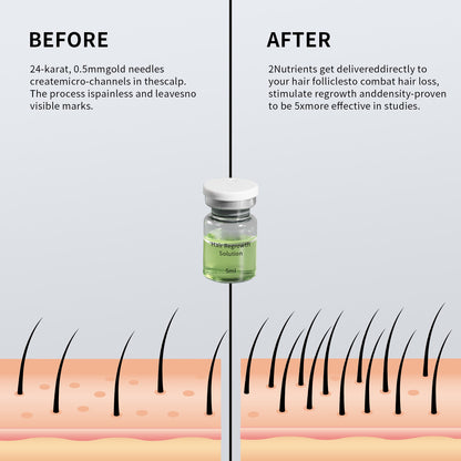 Microneedle Hair Regrowth Serum Set